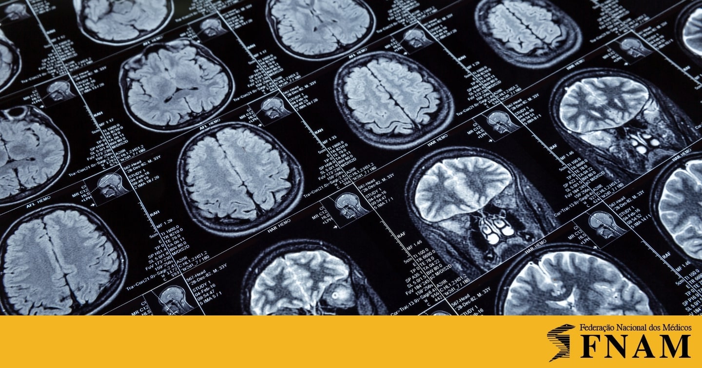 FNAM solidária com greve dos Técnicos Superiores de Diagnóstico e Terapêutica